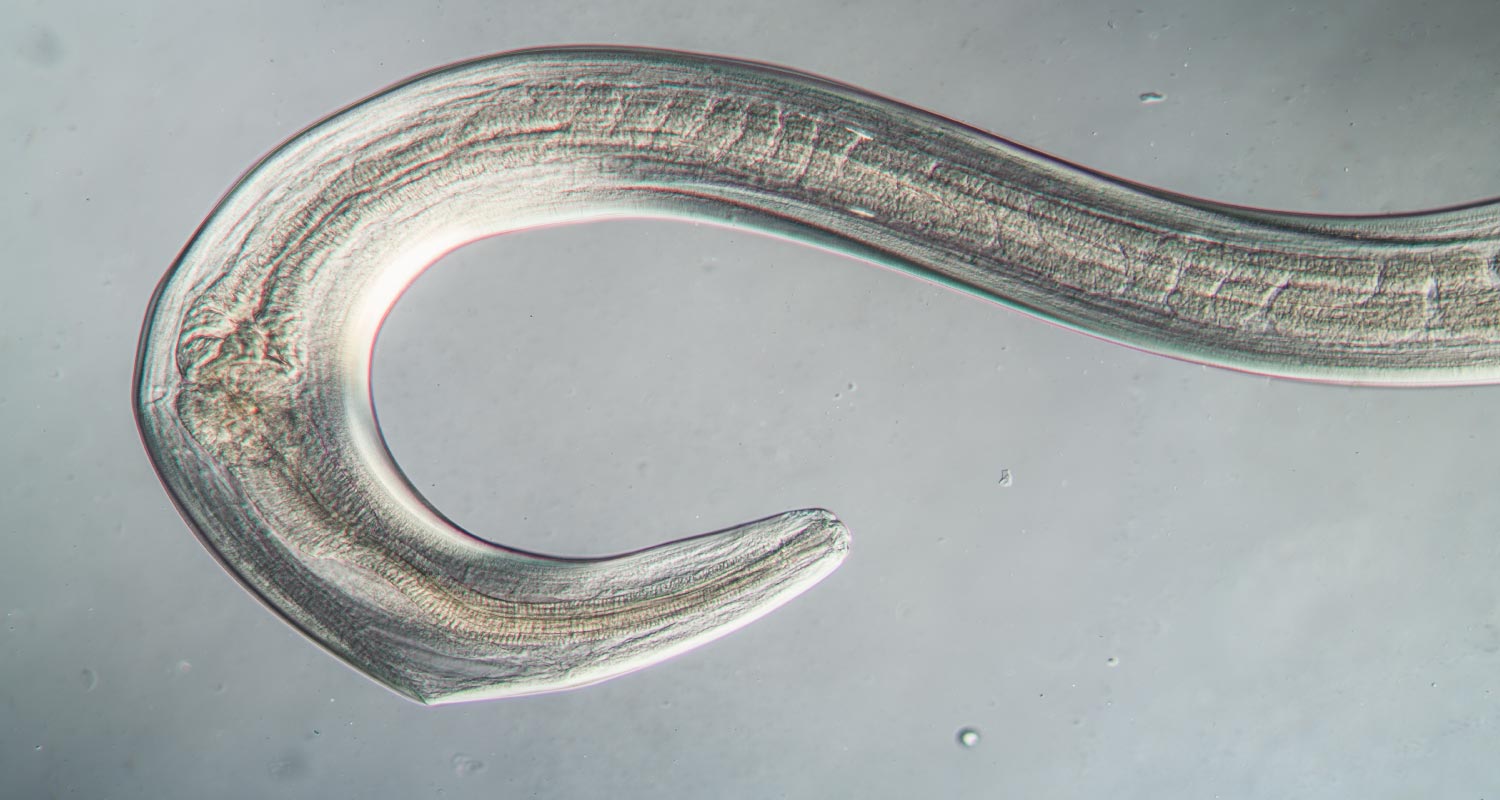 what you need to know about roundworms